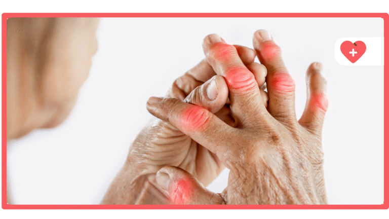Best Cannabis Strains for Arthritis Pain Relief Guide