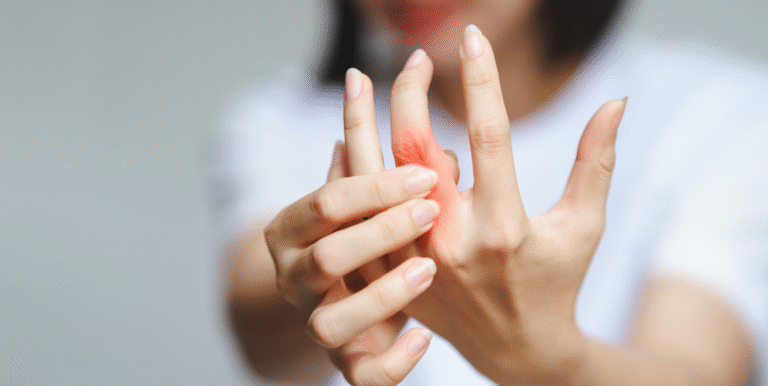 Best Cannabis Strain for Rheumatoid Arthritis