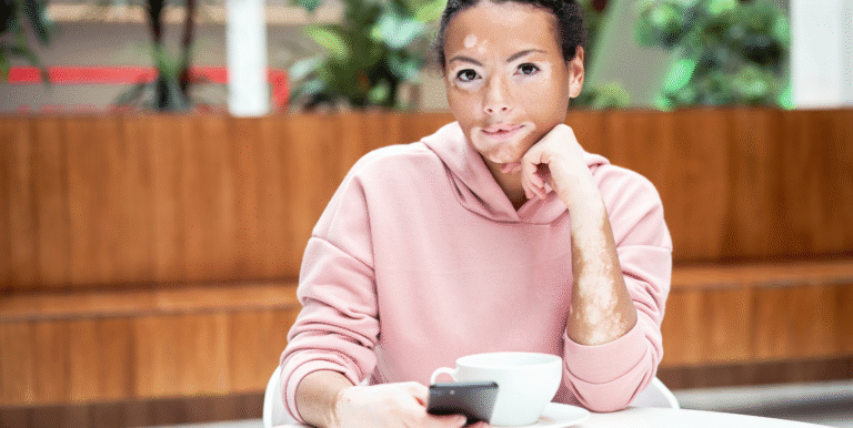 Best Cannabis Strains for Autoimmune Disease